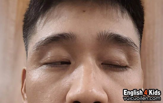 Mắt ti hí tiếng anh là gì